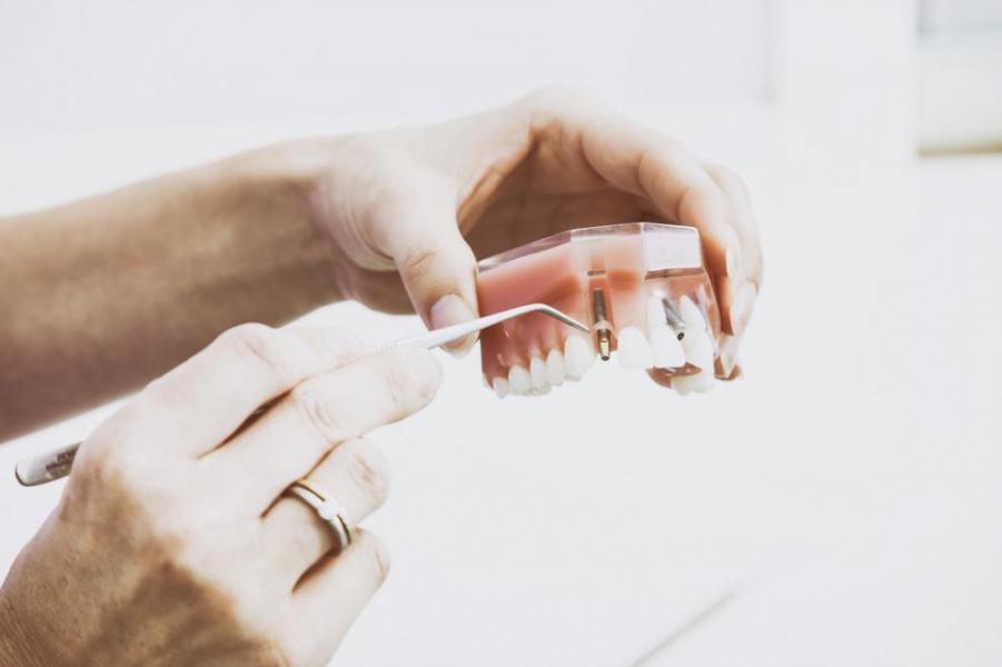 Son dolorosos los tratamientos de colocacin de implantes dentales? - Foto