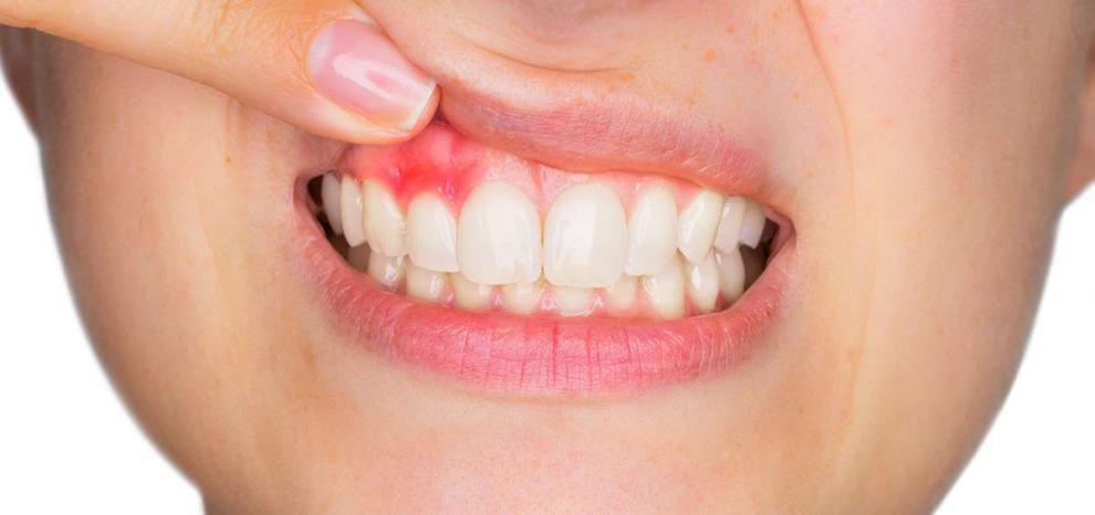 Encas inflamadas: qu indican? - Foto